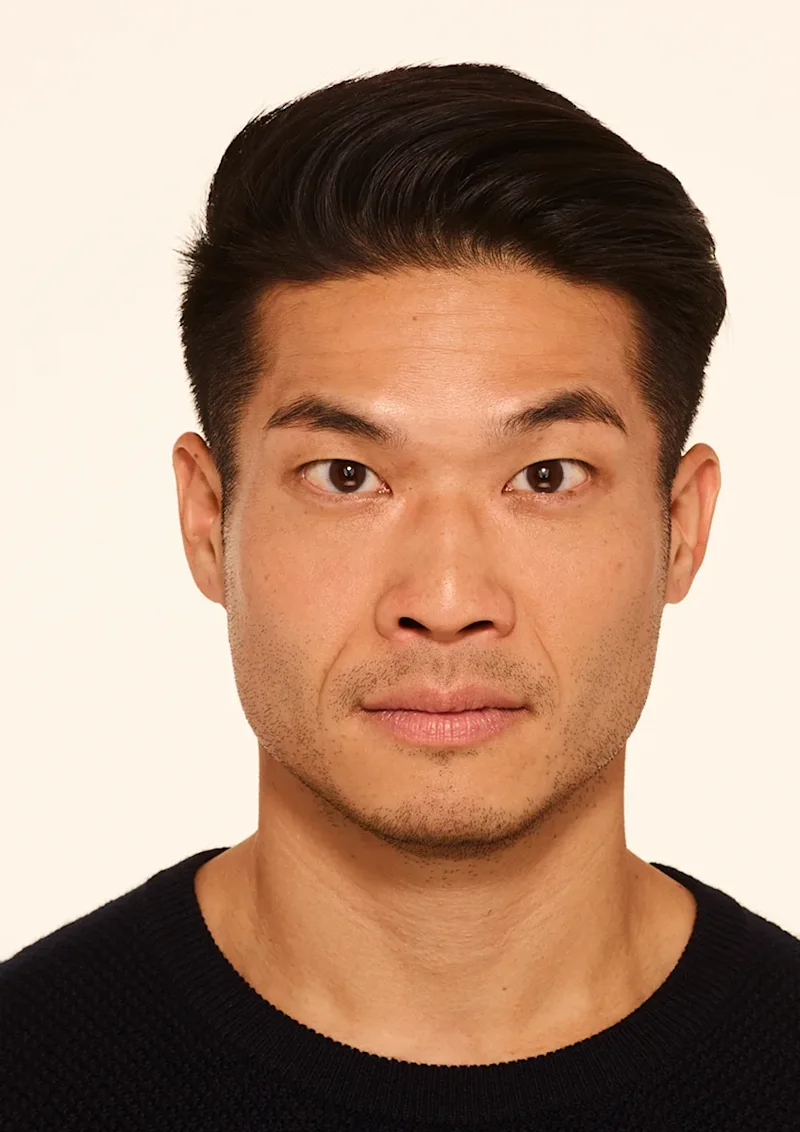 Andrew after Botox treatment