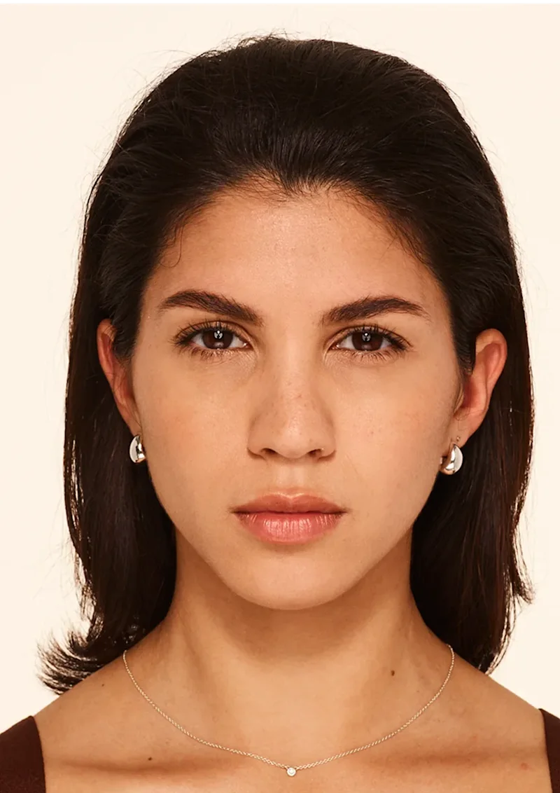 Nicole after Botox treatment
