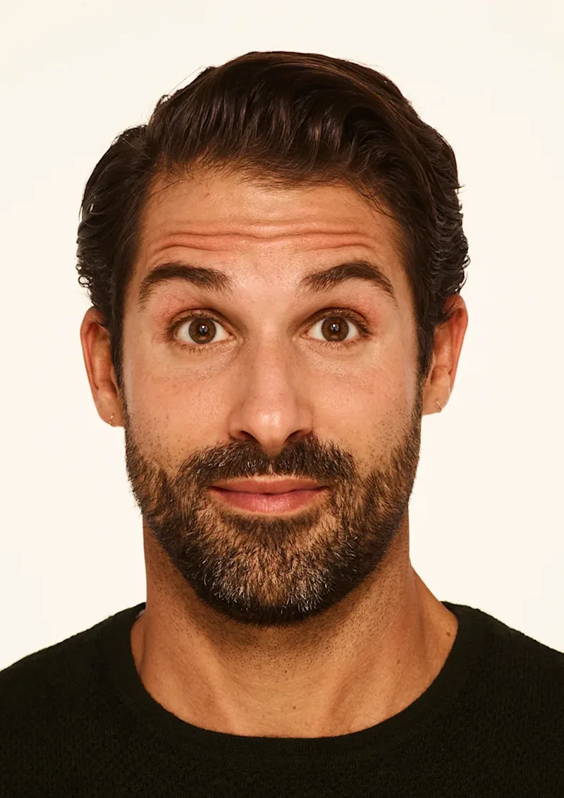 Stephen before Botox treatment
